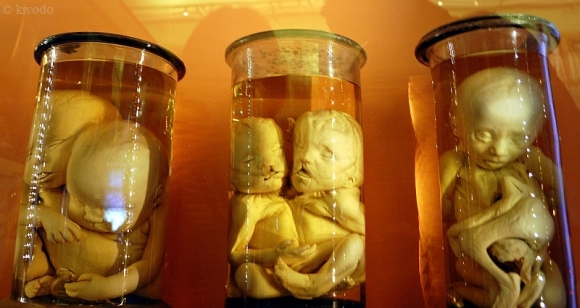 Kunstkamera, rusija,